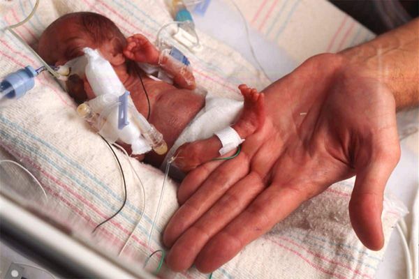 Umbilical Cord Blood Stem Cells Hold Promise as Potential Life-Saving Treatment for Extremely Premature Babies