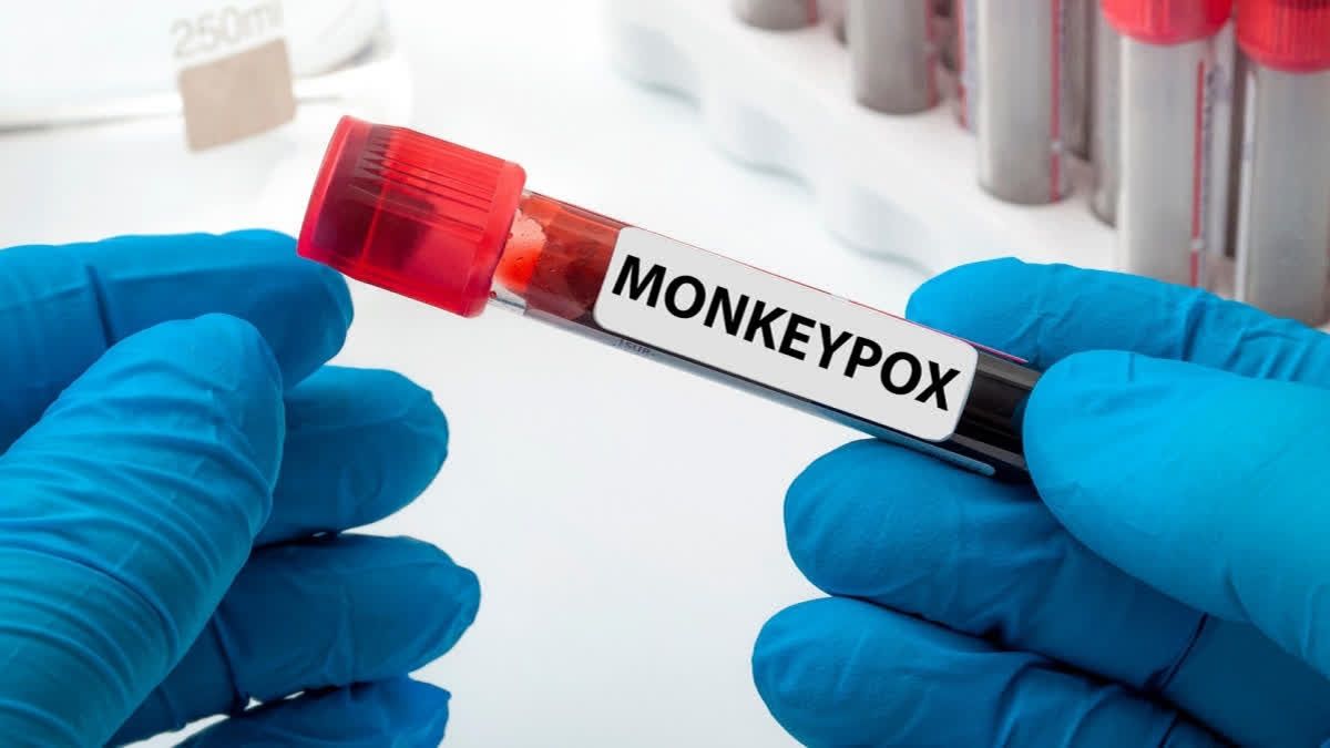 Scientists Uncover Breakthrough Diagnostic Tool Against Monkeypox Virus