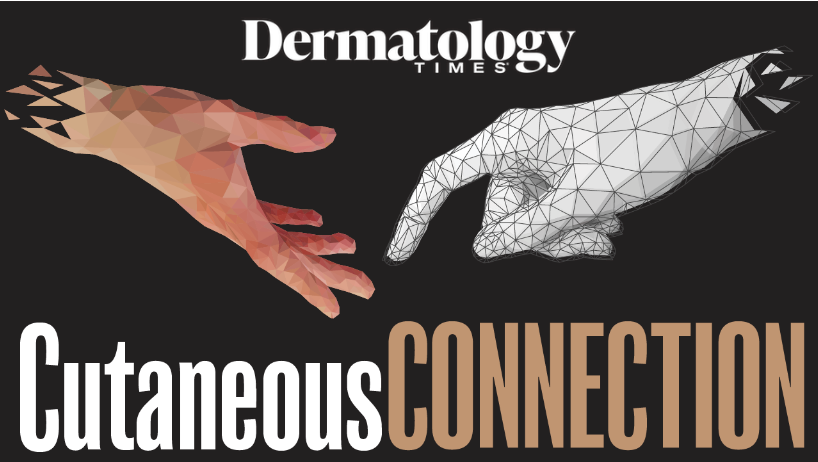 Transformative Potential of Noninvasive Imaging in Managing Vitiligo