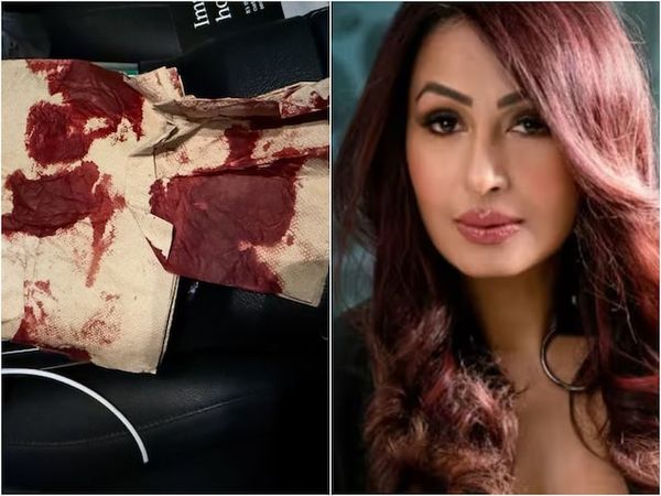 Kashmera Shah Reveals 'Freak Accident' In US, Receives Wishes From Friends