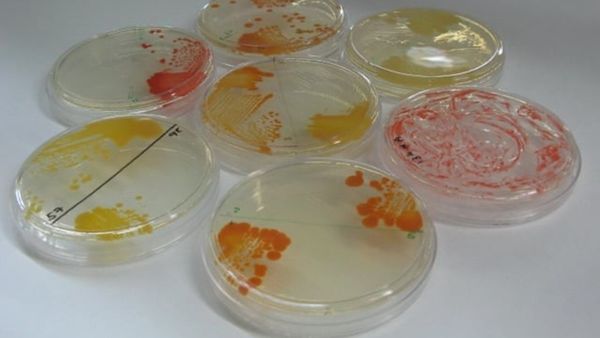 NASA Cleanrooms Hide Secrets of Extremophilic Bacteria