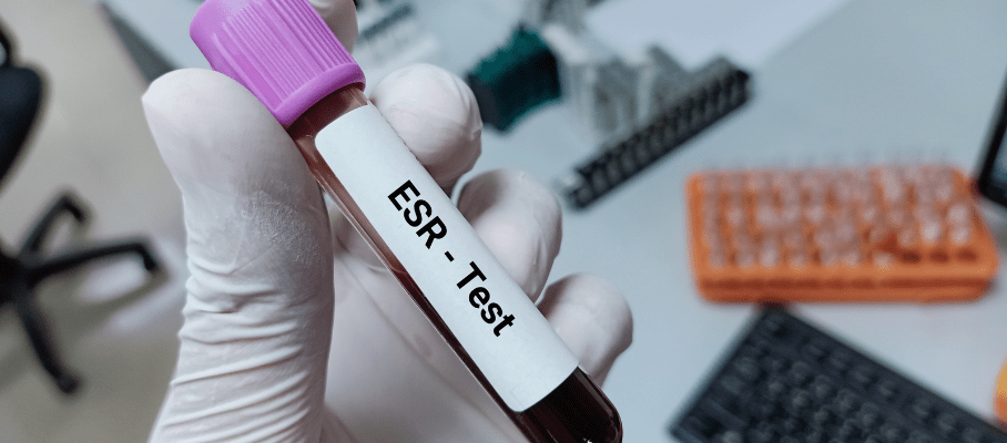 This article provides comprehensive information on the COVID-19 JN.1 variant, including its characteristics, symptoms, treatment options, and precautions to take to protect oneself from infection. Here are the main points summarized: