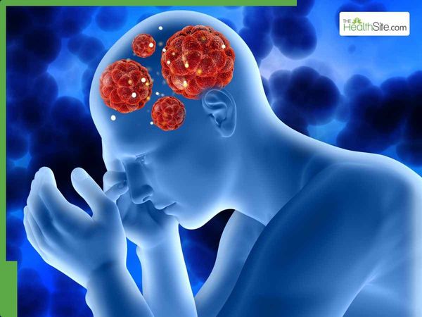 Early Detection and Treatment Key to Saving Lives from Brain Tumors